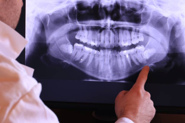 Best Urgent Dental Care  in Jean Fitte, LA