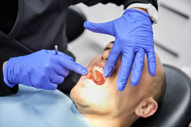 Best Cracked Tooth Emergency Dentist  in Jean Fitte, LA